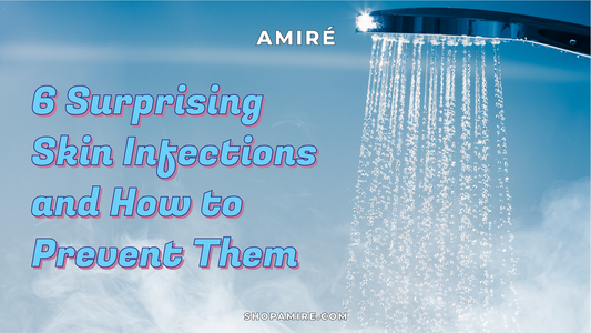 6 Surprising Skin Infections and How to Prevent Them