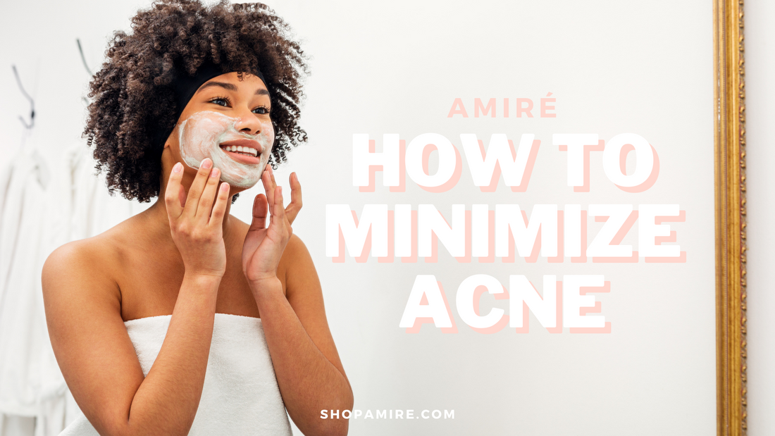 How to Minimize Acne