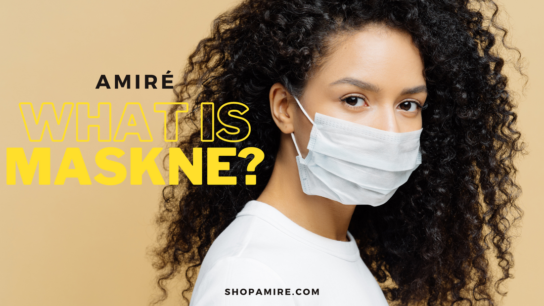 What is Maskne?
